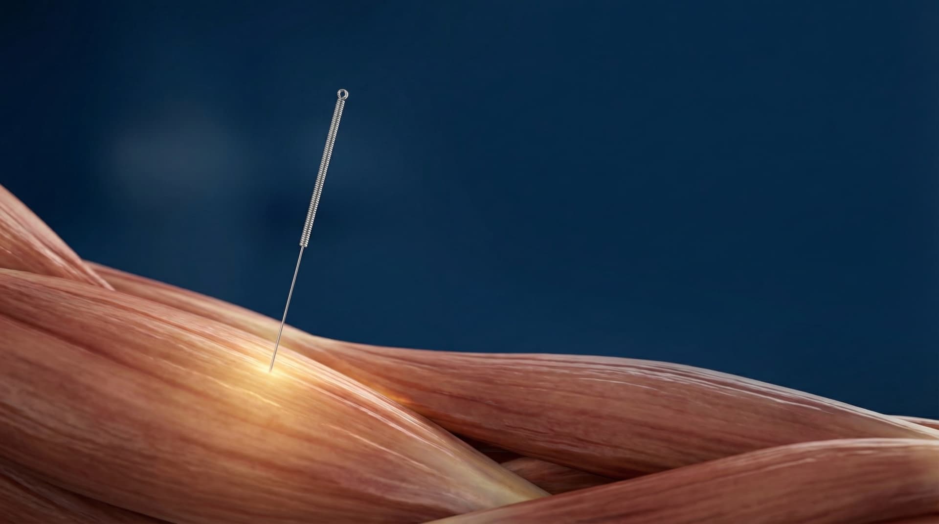 What Is Dry Needling and How Can It Help Your Pain?